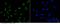 Polo Like Kinase 1 antibody, 101119-T02, Sino Biological, Immunohistochemistry paraffin image 