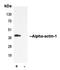 Actin Alpha 1, Skeletal Muscle antibody, LS-C351806, Lifespan Biosciences, Immunoprecipitation image 
