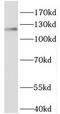 Heterogeneous Nuclear Ribonucleoprotein U antibody, FNab03958, FineTest, Western Blot image 