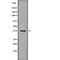 Nei Like DNA Glycosylase 2 antibody, PA5-68188, Invitrogen Antibodies, Western Blot image 