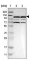 Ras-specific guanine nucleotide-releasing factor 2 antibody, PA5-53842, Invitrogen Antibodies, Western Blot image 