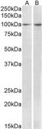 BCAR1 Scaffold Protein, Cas Family Member antibody, STJ73016, St John