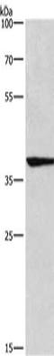 Interferon Regulatory Factor 9 antibody, orb519090, Biorbyt, Western Blot image 