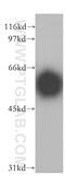 Inositol Hexakisphosphate Kinase 2 antibody, 13155-1-AP, Proteintech Group, Western Blot image 