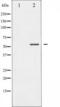 Myocyte Enhancer Factor 2A antibody, TA325686, Origene, Western Blot image 