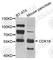 Cyclin Dependent Kinase 16 antibody, A8140, ABclonal Technology, Western Blot image 