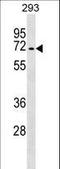 Transforming Growth Factor Beta Receptor 2 antibody, LS-C158277, Lifespan Biosciences, Western Blot image 