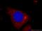 Tropomyosin 2 antibody, 11038-1-AP, Proteintech Group, Immunofluorescence image 
