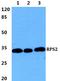 40S ribosomal protein S2 antibody, A03548-2, Boster Biological Technology, Western Blot image 