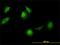 Chaperonin Containing TCP1 Subunit 5 antibody, H00022948-M01, Novus Biologicals, Immunofluorescence image 