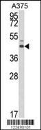 Estrogen Related Receptor Alpha antibody, MBS9212527, MyBioSource, Western Blot image 