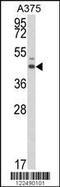 Estrogen Related Receptor Alpha antibody, MBS9212527, MyBioSource, Western Blot image 