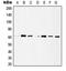 Histone Deacetylase 1 antibody, MBS821032, MyBioSource, Western Blot image 