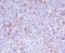 Granzyme B antibody, M00353-1, Boster Biological Technology, Immunohistochemistry paraffin image 