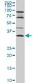 Epithelial Stromal Interaction 1 antibody, orb89804, Biorbyt, Western Blot image 