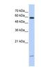 Dynein Light Chain LC8-Type 1 antibody, NBP1-54949, Novus Biologicals, Western Blot image 