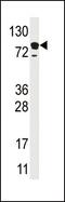 Epidermal Growth Factor Receptor Pathway Substrate 15 antibody, PA5-12046, Invitrogen Antibodies, Western Blot image 