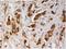 Anterior gradient protein 3 homolog antibody, M05950, Boster Biological Technology, Immunohistochemistry paraffin image 