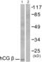 Choriogonadotropin subunit beta antibody, abx013102, Abbexa, Western Blot image 