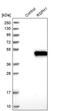 Radial Spoke Head Component 1 antibody, PA5-53497, Invitrogen Antibodies, Western Blot image 