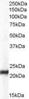 Chromobox 5 antibody, MBS420702, MyBioSource, Western Blot image 