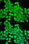 RAB6A, Member RAS Oncogene Family antibody, STJ27580, St John