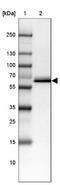 TGH antibody, NBP2-47529, Novus Biologicals, Western Blot image 