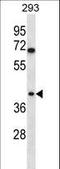 Torsin Family 1 Member B antibody, LS-C160120, Lifespan Biosciences, Western Blot image 