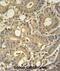 Tryptase Delta 1 antibody, abx025745, Abbexa, Immunohistochemistry paraffin image 