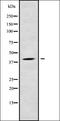Lysophosphatidylglycerol Acyltransferase 1 antibody, orb337946, Biorbyt, Western Blot image 