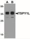Testis Specific Protein Y-Linked 1 antibody, NBP2-41198, Novus Biologicals, Western Blot image 