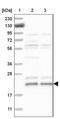 Chromosome 17 Open Reading Frame 49 antibody, NBP1-82671, Novus Biologicals, Western Blot image 