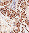 Ring-Box 1 antibody, A00524-1, Boster Biological Technology, Immunohistochemistry paraffin image 