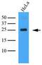 C-Type Lectin Domain Family 4 Member E antibody, GTX53742, GeneTex, Western Blot image 