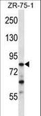 CCR4-NOT Transcription Complex Subunit 3 antibody, LS-C168888, Lifespan Biosciences, Western Blot image 