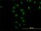 Nuclear Receptor Subfamily 4 Group A Member 2 antibody, H00004929-M10, Novus Biologicals, Immunofluorescence image 