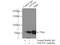 NADH-ubiquinone oxidoreductase 75 kDa subunit, mitochondrial antibody, 12444-1-AP, Proteintech Group, Immunoprecipitation image 