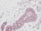 Platelet Derived Growth Factor Subunit A antibody, AHP792, Bio-Rad (formerly AbD Serotec) , Immunohistochemistry paraffin image 