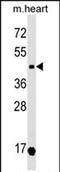 Oxytocin Receptor antibody, PA5-72010, Invitrogen Antibodies, Western Blot image 