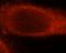 Thymidine Kinase 1 antibody, FNab08718, FineTest, Immunofluorescence image 