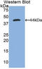 NPHS1 Adhesion Molecule, Nephrin antibody, LS-C295554, Lifespan Biosciences, Western Blot image 