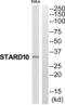 StAR Related Lipid Transfer Domain Containing 10 antibody, abx015072, Abbexa, Western Blot image 