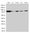 Ezrin antibody, M01750-1, Boster Biological Technology, Western Blot image 