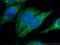 5'-Aminolevulinate Synthase 1 antibody, 16200-1-AP, Proteintech Group, Immunofluorescence image 