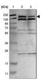 Poly(ADP-Ribose) Polymerase Family Member 14 antibody, NBP1-93592, Novus Biologicals, Western Blot image 