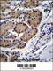 Cathepsin K antibody, 56-632, ProSci, Immunohistochemistry paraffin image 