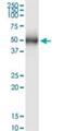 Nucleoporin 43 antibody, H00348995-M03, Novus Biologicals, Western Blot image 