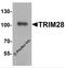 Tripartite Motif Containing 28 antibody, 2521, ProSci, Western Blot image 