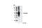 Frizzled Class Receptor 5 antibody, 5266S, Cell Signaling Technology, Western Blot image 