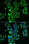 Glutamate Dehydrogenase 2 antibody, LS-C334823, Lifespan Biosciences, Immunofluorescence image 